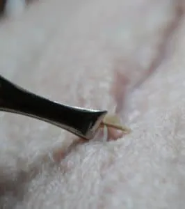 Federkiele werden sorgfältig von der Gänsebrusthaut entfernt