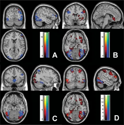 graphic file with name 4FF2.jpg