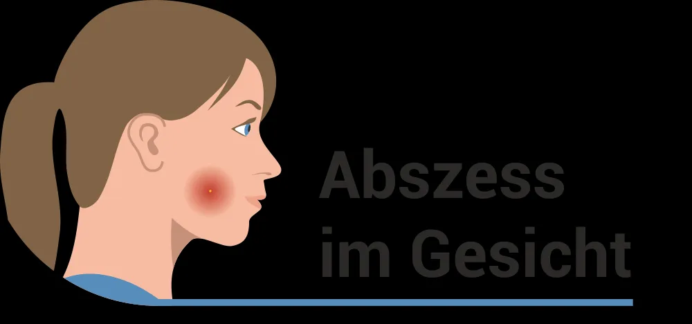 Abszess im Gesicht
