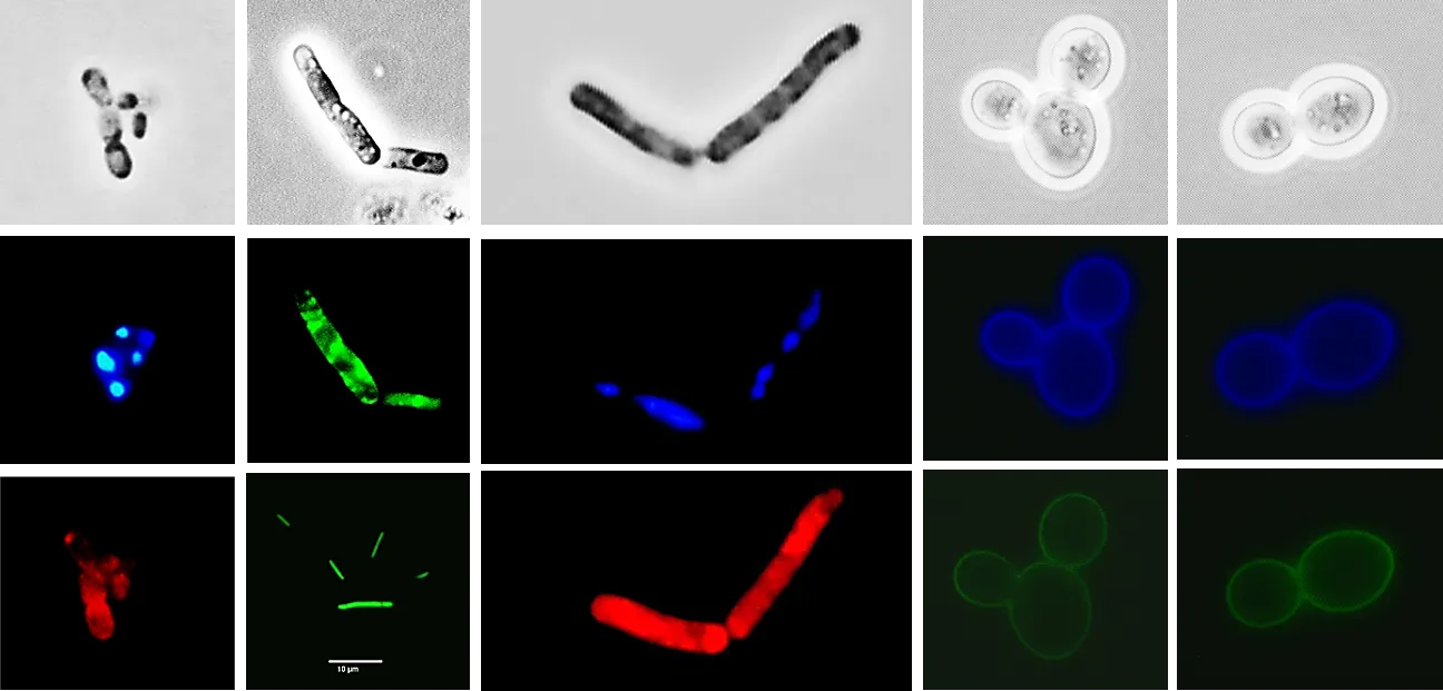Mikroskopische Ansicht gefärbter Zellen
