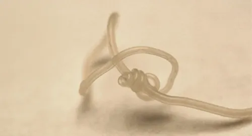 Ein Bild des Herzwurms dirofilaria immitis