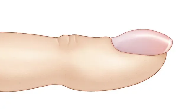 Ein Uhrglasnagel mit stark gewölbter Form